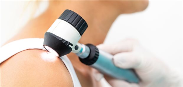 Sinnvolle IGeL? Jahrelang war der Mehrwert der Auflichtmikroskopie beim Hautkrebsscreening umstritten. Seit 2020 ist sie Bestandteil im GKV-Leistungskatalog.