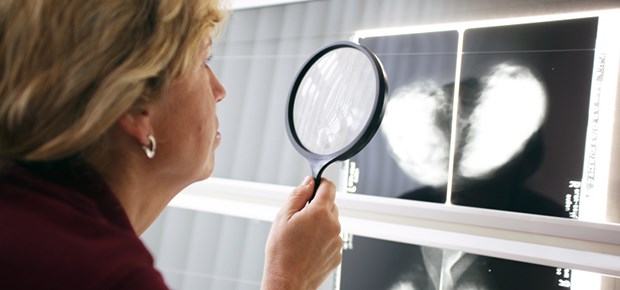 Mammografie enttäuscht - erneut Skeptischer Blick: Erneut liefert eine Studie ernüchternde Daten zum Mamma-Ca-Screening.