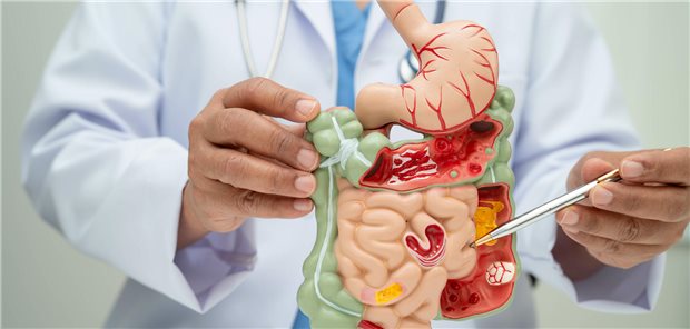 Ein Arzt erklärt anhand eines Modells der Anatomie des menschlichen Verdauungssystem (Magen und Darm) einem Patienten die Diagnose und die Behandlungstrategie.