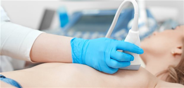 Sonografie der Brust: Bei Patientinnen mit dichtem Brustgewebe wird zur Brustkrebsfrüherkennung häufig zusätzlich zur Mammografie eine Ultraschalluntersuchung vorgenommen.
