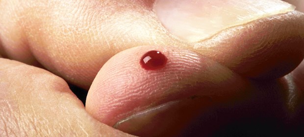 Erst Krebs, dann Diabetes Spätfolge Blutzuckermessung: Eine Bestrahlung des Pankreasschwanz erhöht offenbar das Diabetesrisiko.