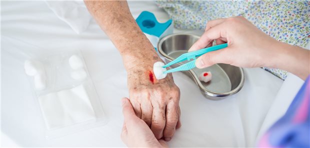 Pflegekräfte sollen mehr Verantwortung in der Versorgung übernehmen Spahn plant „Blankoverordnung“ auch für Pflegekräfte. Darunter soll auch die Wundbehandlung fallen.