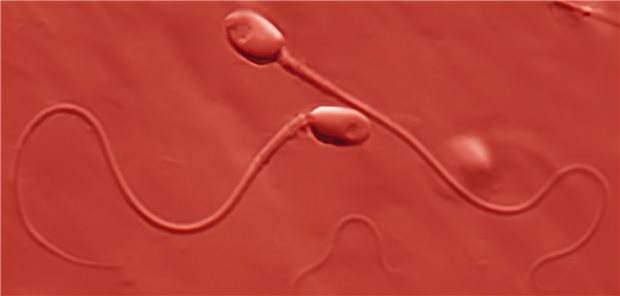 Kein SARS-CoV-2 im Sperma gefunden Spermien: In Spermienflüssigkeit können bestimmte Viren nachgewiesen werden.