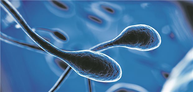 Hitzewellen setzen auch Nieren und Spermien zu Elektronenmikroskopische Aufnahme von Spermien.