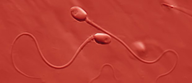 Jungbrunnen für Spermien Spermien in rot: Vielleicht hilft eine Vitaminkur.