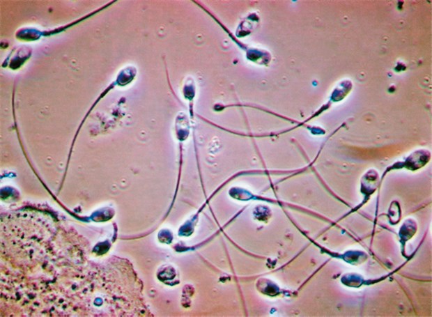 Spermien mikroskop Sperma im