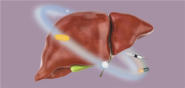 Sphären der Hepatitis D-Therapie: Bei allen Patientinnen und Patienten mit chronischer HDV-Infektion und nachweisbarer HDV-RNA sollte die Möglichkeit einer antiviralen Therapie geprüft werden.