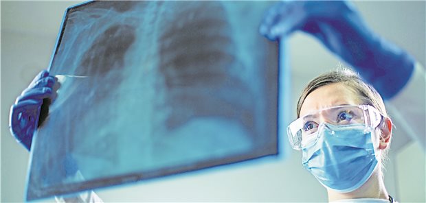 Spuren von Tuberkulose zu sehen? Ältere Patienten aus der Ukraine sollten Hausärzte vorsichtshalber zum Radiologen überweisen. (Symbolbild mit Fotomodell)
