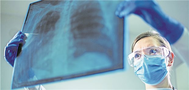 Spuren von Tuberkulose zu sehen? Ältere Patienten aus der Ukraine sollten Hausärzte vorsichtshalber zum Radiologen überweisen. (Symbolbild mit Fotomodell)