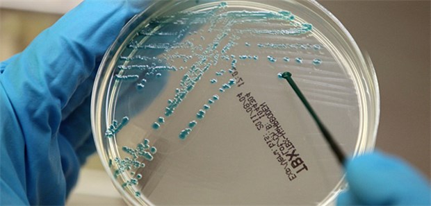 Im Kreislauf zwischen Mensch und Tier Stammbaum-Analysen von E.coli-Bakterien sind unverzichtbar, um die Entwicklung, Verbreitung und Übertragung von Krankheitserregern und Antibiotikaresistenzen zu verfolgen.