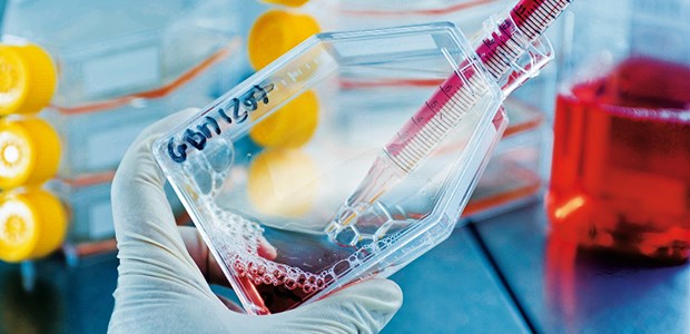 Stammzellen gegen Querschnittlähmung Stammzellen: Bei querschnittsgelähmten US-Patienten haben sie geholfen,