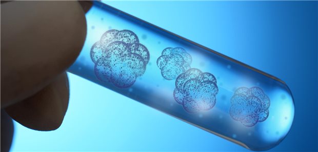 Stammzellen: COPD-Patienten wurde per bronchoskopischer Bürstenbiopsie P63-positive Progenitor-Zellen aus den Lungen entnommen. Die Zellen wurden von den Wissenschaftlern millionenfach expandiert und als gereinigtes Zellprodukt bronchoskopisch re-transplantiert.