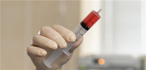 Spritze mit Stammzellen aus dem Knochenmark