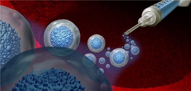 Stammzellen oder doch besser moderne Arzneien – beide Therapien scheinen neue MS-Schübe ähnlich gut zu unterdrücken.