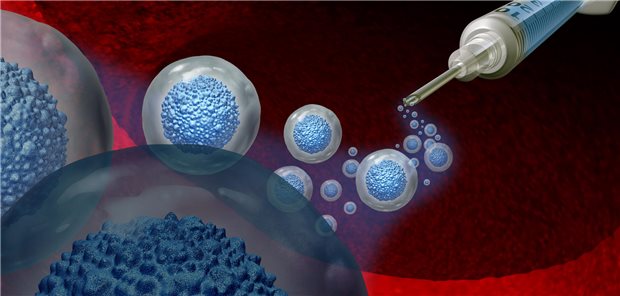 Schematische Darstellung einer Stammzelltransplantation