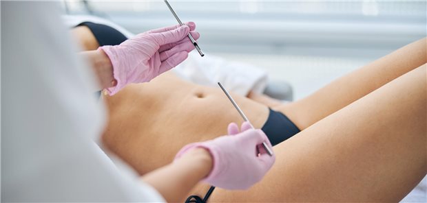 Eine Ärztin bereitet die Durchführung einer Hautbiopsie vor.