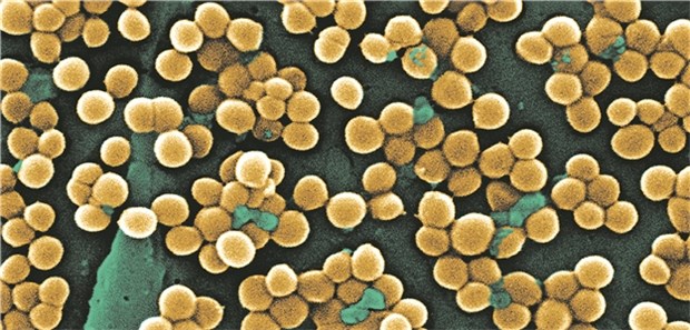 Statine mit antibakterieller Wirkung Staphylococcus-aureus: Das Risiko für eine Bakteriämie war unter Statin- Anwendung um fast 30 Prozent reduziert.