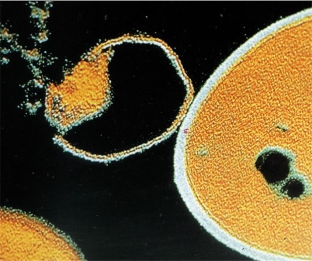 Antibiotika-Resistenz nimmt stark zu Staphylococcus aureus: Der linke Partikel löst sich nach Antibiotika-Zugabe auf. Zunehmend werden Antibiotika-resistente Staphylokokken isoliert.