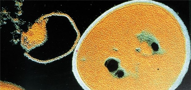 Antibiotika gezielt Herunterfahren Staphylococcus aureus: Der linke Partikel löst sich nach Antibiotika-Zugabe auf.