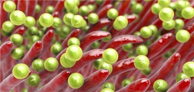 Staphylococcus aureus: In Ländern mit hohem Einkommen sind vor allem resistente S.-aureus- und E.-coli-Bakterien eine Gefahr. Auf sie wurden einer aktuellen Analyse zufolge 26 Prozent beziehungsweise 23 Prozent aller Todesfälle durch Resistenzen zurückgeführt.