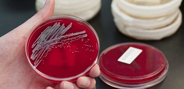 MRSA-Meldepflicht zeigt ihre Wirkung Staphylococcus aureus in der Petrischale - sind es MRSA?