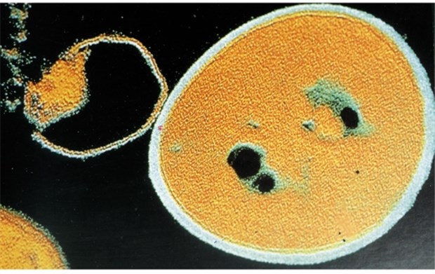 Bei Aufnahme in Klinik Test auf MRSA? Staphylococcus aureus ist der Problemkeim im Krankenhaus.