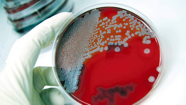 Staphylococcus aureus ist ein häufiger Erreger bei onkologischen Patienten mit Granulozytopenie.