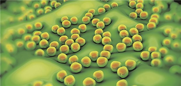 Staphylococcus aureus kann multiple Resistenzen entwickeln (MRSA). Mit den richtigen Maßnahmen kann dies reduziert werden.