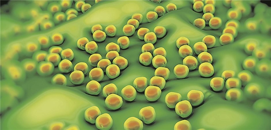 Staphylococcus Aureus Behandlung Ohne Antibiotika www.aerztezeitung.de