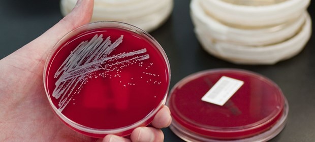 GBA gründet Task-Force gegen Keime Staphylokokken: Gegen MRSA schmiedet der GBA jetzt Pläne.