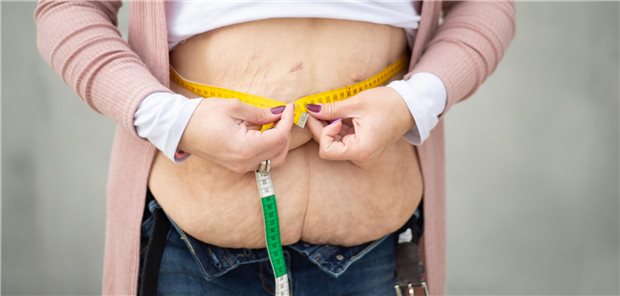 Starker Gewichtsverlust nach bariatrischer Chirurgie: Der Eingriff bessert zudem auch langfristig die Stoffwechselsituation bei Typ-2-Diabetes.