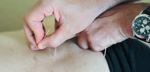 Akupunktur hilft gegen Übelkeit Statt Erbrechen: Nadeln.