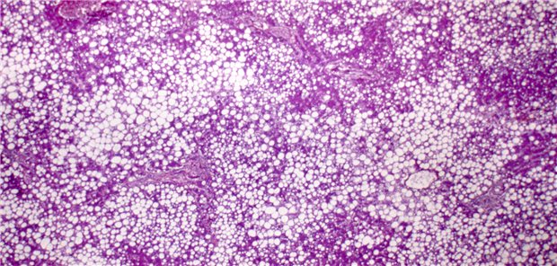 Dreidimensionale gerenderte Illustration des Röntgenhologramms einer menschlichen Leber.