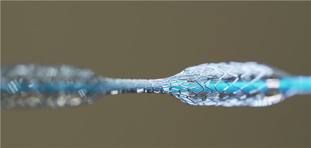Stent: Italienische Kardiologen haben untersucht, wann eine komplette Revaskularisierung, auch mit Stents, bei Patienten mit einem hohen Blutungsrisiko infrage kommt.