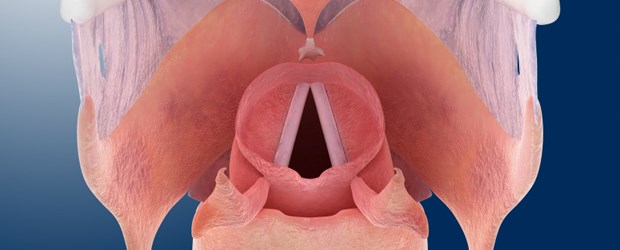 Schrittmacher gegen gelähmte Stimmlippen Stimmlippen: Ein neuer Schrittmacher soll bei einer Lähmung helfen.