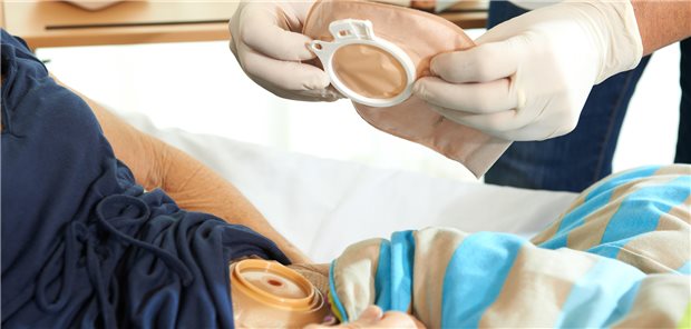Stoma-Versorgung mit Hilfsmitteln: Das Bundeskartellamt moniert wettbewerbswidrige Preisabsprachen zwischen den Anbieterverbänden und quasi-monopolartige Strukturen. 