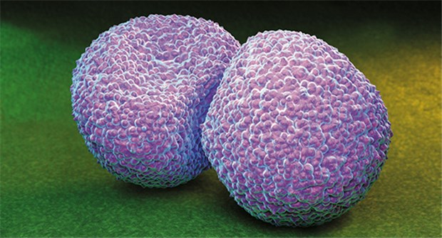 Pneumonie-Risiko mit vier Fragen erkennen Streptococcus pneumoniae - hier eine rasterelektronenmikroskopische Aufnahme - verursacht etwa jede zweite ambulant erworbene Pneumonie in Deutschland.