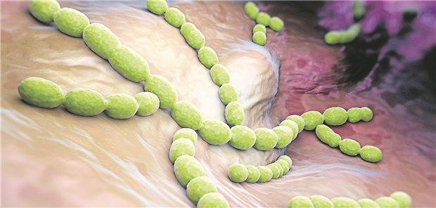 Streptococcus pneumoniae ist einer der häufigsten Erreger einer Sepsis.