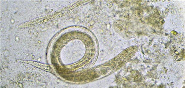 Strongyloides stercoralis - mit dem Mikroskop in einer Stuhlprobe entdeckt.