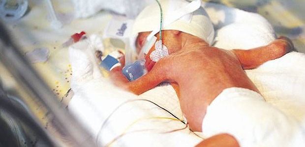 Surfactant kann sehr kleinen Frühgeborenen auch bei einer CPAP-Beatmung verabreicht werden.