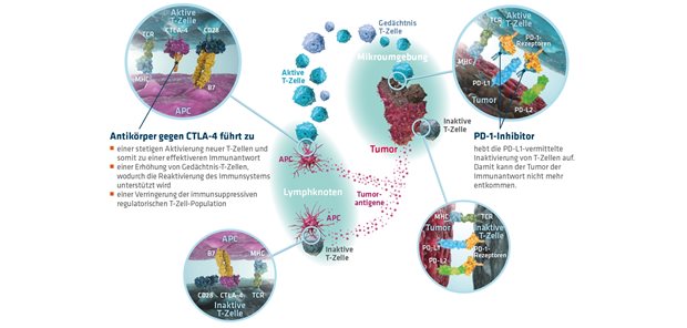 Die Ära der Immunonkologie: bessere Chancen für Krebspatienten Synergistische Effekte der immunonkologischen Kombination von PD-1-Inhibitoren und Antikörper gegen CTLA-4. APC: Antigen-präsentierende Zelle; CTLA-4: cytotoxic T lymphocyte-associated protein 4; MHC: major histocompatibility complex; PD-1: programmed cell death protein 1; PD-L1: programmed death ligand 1; TCR: T-Zell-Rezeptor; mod nach Wolchok4, Peggs5, Blank6, Hamanishi7, Nurieva8