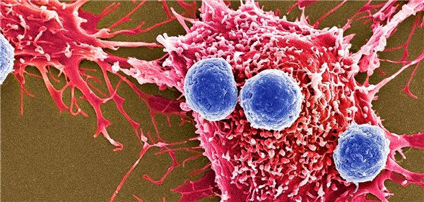 T-Lymphozyten stehen im Zentrum der adoptiven Immuntherapie gegen Krebs.