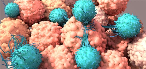 T-Zellen attackieren Krebszellen - Basis einer Therapieoption, die jetzt auch für Patienten mit soliden Tumoren entwickelt wird.