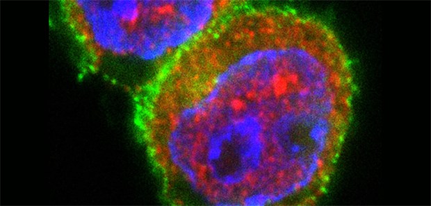 Neuer Ansatz für die Therapie bei Diabetes? T-Zellen nach Stimulation in Gegenwart von miRNA181a. Immunfluoreszenzfärbung von T-Zellen (grün: T-Zellmarker CD4, rot: Transkriptionsfaktor NFAT5, blau: Zellkern). Die Stimulation der T-Zellen in Gegenwart eines miRNA181a mimics resultiert in einer deutlich erhöhten NFAT5-Expression in den T-Zellen.