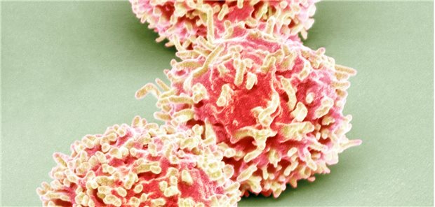 T-Zellen unter dem Elektronenmikroskop: