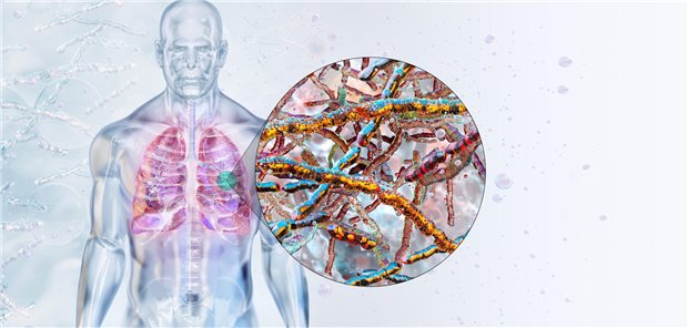 Schematische Darstellung von Tuberkulose-Erregern