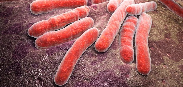 TB-Erreger: Auf latente Tuberkulose sollte nur getestet werden, wenn man auch behandelt.