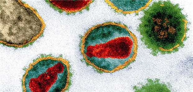 TEM-Aufnahme von HI-Viren.