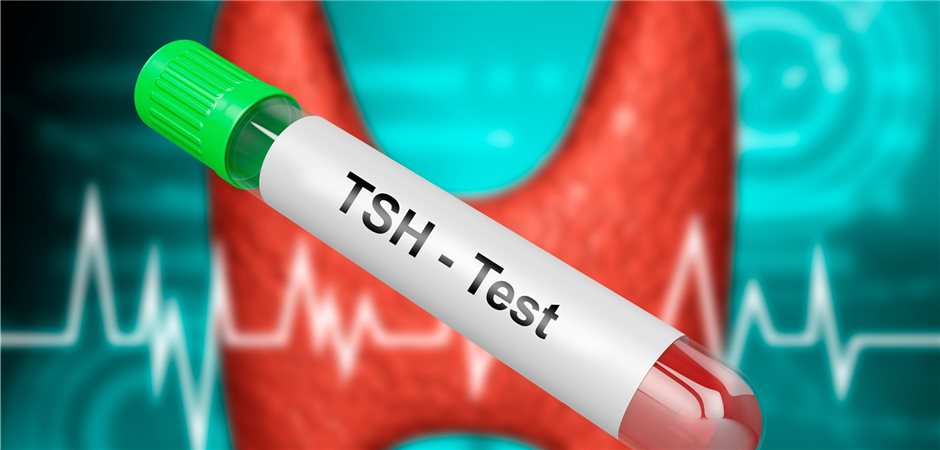 Tsh Wert Senken Ohne Tabletten www.aerztezeitung.de