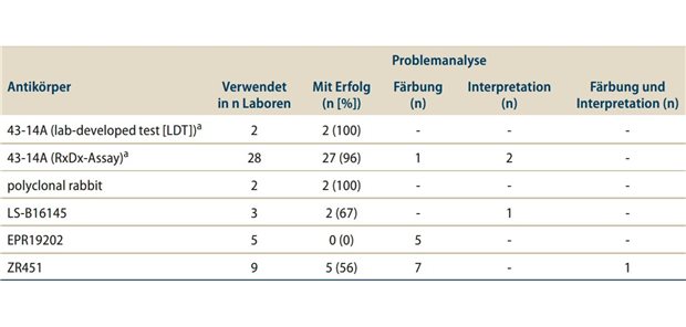 Tab. 1: Im Rahmen des Ringversuchs eingesetzte Anti-Claudin-18.2-Antikörperklone: Erfolgsraten und Problemanalyse. Berücksichtigt wurden Antikörper, die in 2 Laboren verwendet wurden
